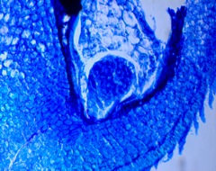 Soybean embryo under microscope.